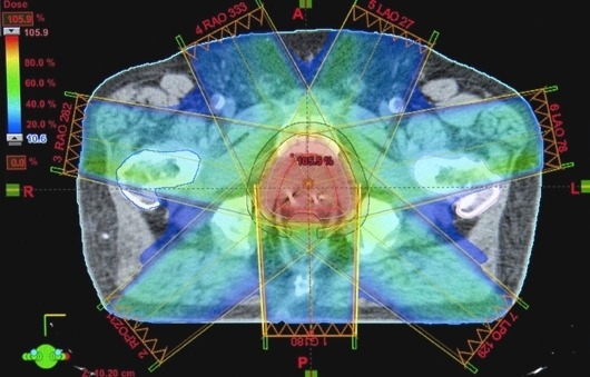 GVSU Announces New Graduate Program in Medical Dosimetry